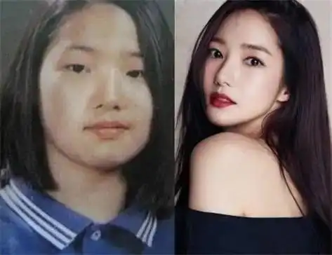 韩国整容文化_韩剧女主整容前后对比_韩剧整容女明星